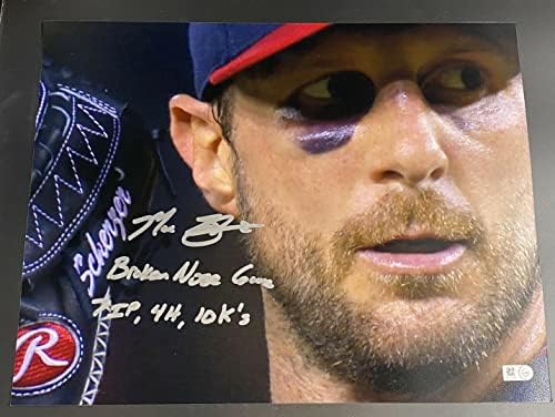 Макс Шерцер Счупен Нос В играта 7IP, 4H, 10 Ks Подписано Голографическое снимка 11x14 MLB - Снимки на MLB с автограф